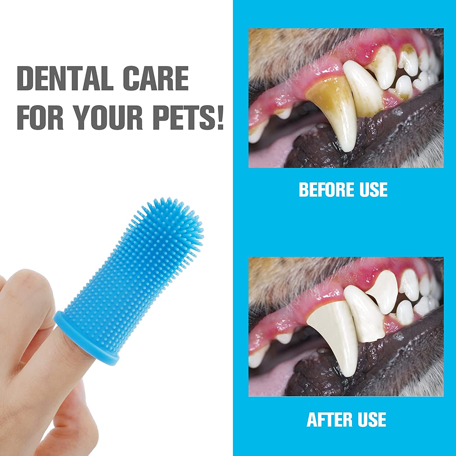 Finger Toothbrush Teeth Cleaning